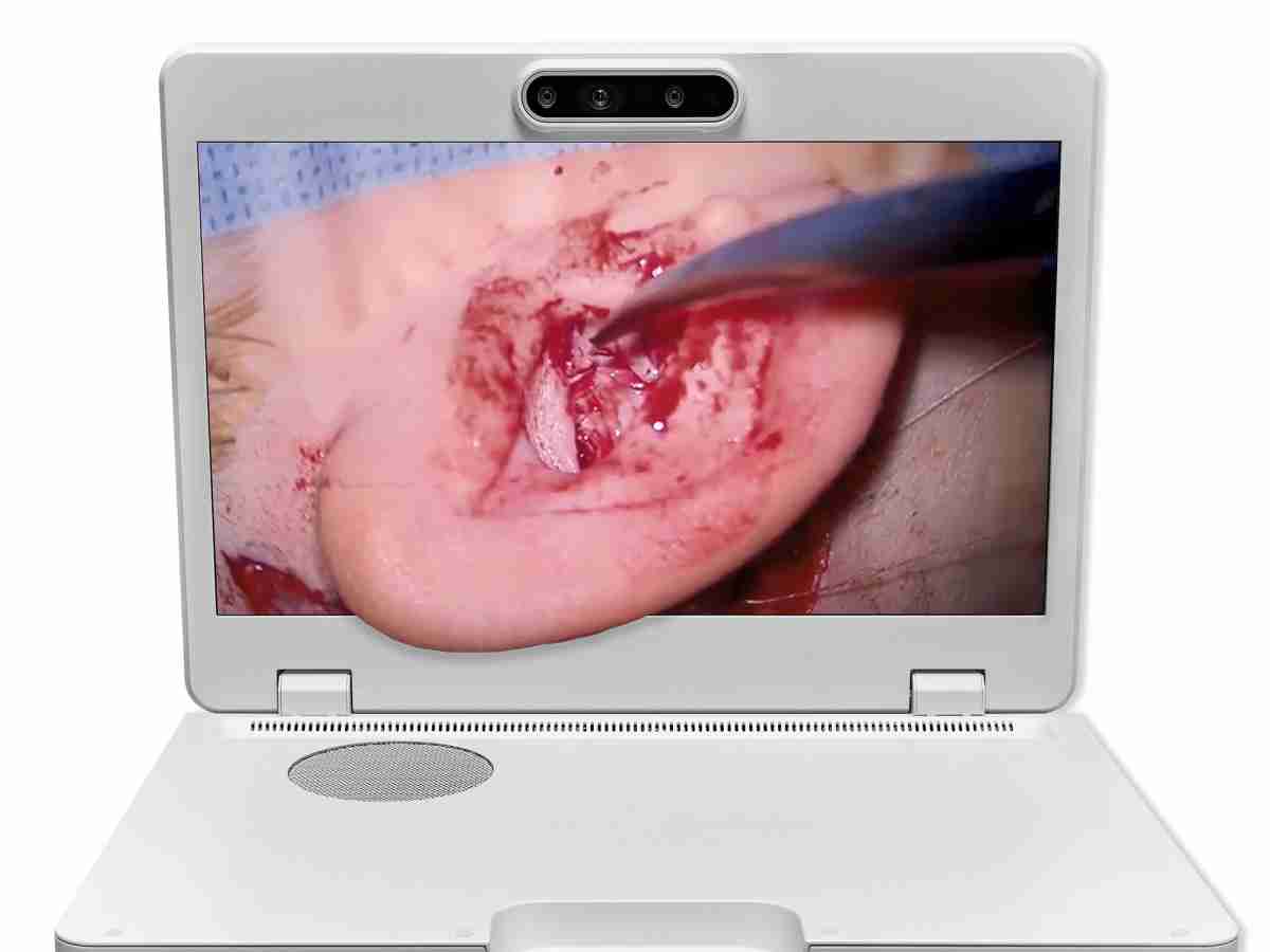 达擎之＂Heads-up 3D显微手术显示系统＂，，，整合4K裸眼3D显示及眼球追踪系统，，，具备快速追踪人眼移动位置功能，，，，减轻医师长时间维持固定姿势的负担，，，，让医师能有更宽广清晰的3D立体视野及更舒适的姿势来执行手术。。